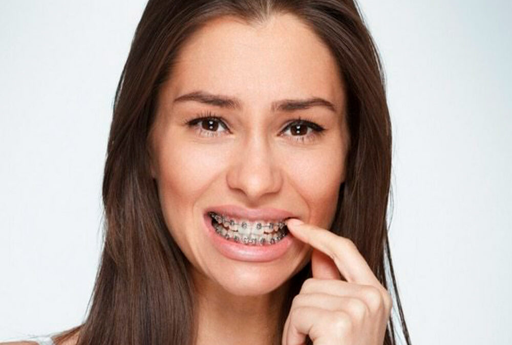 Ways To Ease Braces Pain Omar Orthodontics