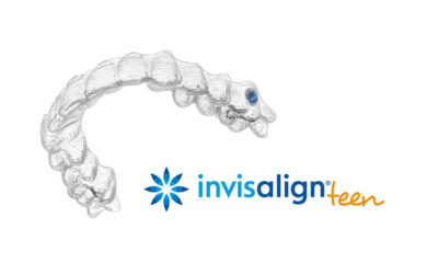 Invisalign®: What Are the Benefits?