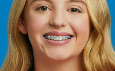 Do Traditional Metal Braces Hurt? What to Expect During Treatment