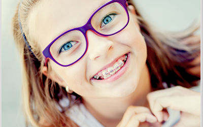 Do You Know About the Benefits of Braces?